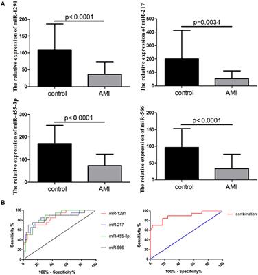 A Four-MicroRNA Panel in Peripheral Blood Identified as an Early Biomarker to Diagnose Acute Myocardial Infarction
